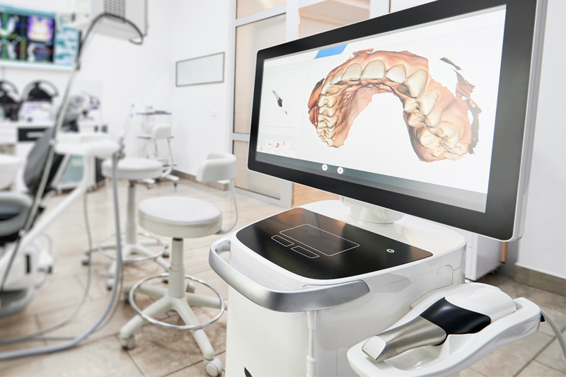 Intra-Oral Scanner in New York